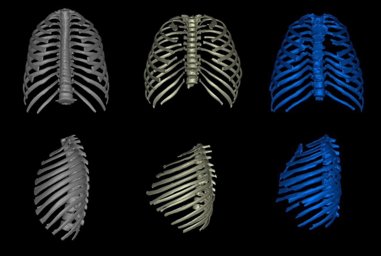 Rib cage anatomy in Homo erectus suggests a recent evolutionary